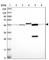 Aldehyde Dehydrogenase 6 Family Member A1 antibody, HPA029075, Atlas Antibodies, Western Blot image 