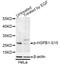 Heat Shock Protein Family B (Small) Member 1 antibody, STJ22178, St John