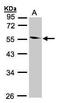 Coronin 1B antibody, GTX106831, GeneTex, Western Blot image 