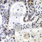 LSM2 Homolog, U6 Small Nuclear RNA And MRNA Degradation Associated antibody, A7988, ABclonal Technology, Immunohistochemistry paraffin image 