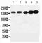 Neurotrophic Receptor Tyrosine Kinase 1 antibody, PA1321, Boster Biological Technology, Western Blot image 