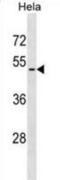 Vasoactive Intestinal Peptide Receptor 2 antibody, abx029212, Abbexa, Western Blot image 