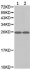 Ubiquitin C-Terminal Hydrolase L1 antibody, TA321632, Origene, Western Blot image 
