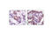 STAT3 antibody, 9139S, Cell Signaling Technology, Immunohistochemistry paraffin image 
