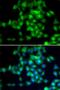 NAD-dependent deacetylase sirtuin-3 antibody, orb247889, Biorbyt, Immunocytochemistry image 