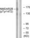 NMDAR2B antibody, LS-C199332, Lifespan Biosciences, Western Blot image 