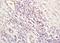 Lysyl oxidase homolog 2 antibody, orb221455, Biorbyt, Immunohistochemistry paraffin image 