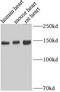 Myosin Binding Protein C, Cardiac antibody, FNab05455, FineTest, Western Blot image 