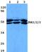 Mitogen-Activated Protein Kinase 8 antibody, A02608T183Y185, Boster Biological Technology, Western Blot image 