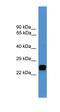 Ubiquitin C-Terminal Hydrolase L1 antibody, orb331010, Biorbyt, Western Blot image 