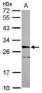 Cyclin-dependent kinase 10 antibody, PA5-30567, Invitrogen Antibodies, Western Blot image 