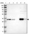 Carbonyl Reductase 1 antibody, PA5-53799, Invitrogen Antibodies, Western Blot image 