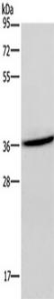 C-X-C Motif Chemokine Receptor 6 antibody, TA349839, Origene, Western Blot image 