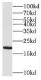 Mitochondrial Ribosomal Protein L52 antibody, FNab05338, FineTest, Western Blot image 