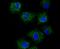 Tyrosinase Related Protein 1 antibody, A01959, Boster Biological Technology, Immunocytochemistry image 