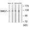 Protein SMG7 antibody, PA5-49860, Invitrogen Antibodies, Western Blot image 
