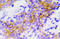 ALK Receptor Tyrosine Kinase antibody, AP21011PU-N, Origene, Immunohistochemistry frozen image 