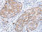 Ras Association Domain Family Member 1 antibody, CSB-PA192001, Cusabio, Immunohistochemistry paraffin image 