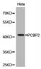 CTBP antibody, TA327374, Origene, Western Blot image 