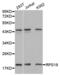 Ribosomal Protein S19 antibody, abx004660, Abbexa, Western Blot image 