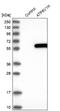 ATPase H+ Transporting V1 Subunit H antibody, NBP1-85668, Novus Biologicals, Western Blot image 