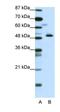 Zinc finger protein ZPR1 antibody, orb329982, Biorbyt, Western Blot image 