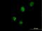 Ring Finger Protein 113B antibody, H00140432-B01P, Novus Biologicals, Immunofluorescence image 