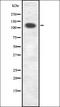 Unc-51 Like Autophagy Activating Kinase 1 antibody, orb336668, Biorbyt, Western Blot image 