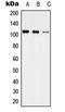 Ubiquitin carboxyl-terminal hydrolase 35 antibody, LS-C353839, Lifespan Biosciences, Western Blot image 