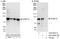 Dual Specificity Tyrosine Phosphorylation Regulated Kinase 1A antibody, A303-802A, Bethyl Labs, Immunoprecipitation image 