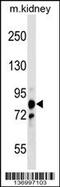 Polyribonucleotide Nucleotidyltransferase 1 antibody, 59-288, ProSci, Western Blot image 