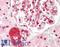 Zinc Finger And BTB Domain Containing 40 antibody, LS-B8836, Lifespan Biosciences, Immunohistochemistry paraffin image 