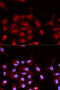 ABL Proto-Oncogene 1, Non-Receptor Tyrosine Kinase antibody, abx000091, Abbexa, Western Blot image 