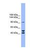 Ectonucleotide Pyrophosphatase/Phosphodiesterase 2 antibody, NBP1-59852, Novus Biologicals, Western Blot image 