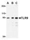 Toll Like Receptor 9 antibody, AP05241PU-N, Origene, Western Blot image 