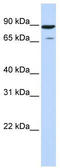 Homeodomain Interacting Protein Kinase 4 antibody, TA340353, Origene, Western Blot image 