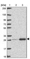 Ribosomal Protein L10a antibody, PA5-62845, Invitrogen Antibodies, Western Blot image 