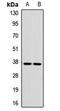 Glycoprotein IX Platelet antibody, LS-C667970, Lifespan Biosciences, Western Blot image 