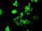 Fermitin Family Member 2 antibody, MA5-24938, Invitrogen Antibodies, Immunocytochemistry image 