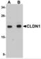 Claudin 1 antibody, NBP1-77036, Novus Biologicals, Western Blot image 