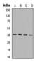 Protein Kinase AMP-Activated Non-Catalytic Subunit Beta 1 antibody, orb393137, Biorbyt, Western Blot image 