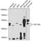 Cytochrome P450 11B2, mitochondrial antibody, 15-536, ProSci, Western Blot image 