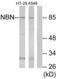 Nibrin antibody, LS-C119580, Lifespan Biosciences, Western Blot image 