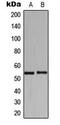 Histidyl-tRNA synthetase, cytoplasmic antibody, MBS8206456, MyBioSource, Western Blot image 