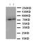 ATP Binding Cassette Subfamily D Member 3 antibody, LS-C313210, Lifespan Biosciences, Western Blot image 