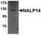 NLR Family Pyrin Domain Containing 14 antibody, A11472, Boster Biological Technology, Western Blot image 