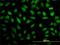 Mediator Complex Subunit 16 antibody, H00010025-M02, Novus Biologicals, Immunocytochemistry image 