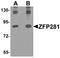 Zinc Finger Protein 281 antibody, LS-C144346, Lifespan Biosciences, Western Blot image 