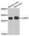 UL16 Binding Protein 2 antibody, A8264, ABclonal Technology, Western Blot image 