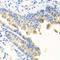 Nyctalopin antibody, A07548, Boster Biological Technology, Immunohistochemistry frozen image 